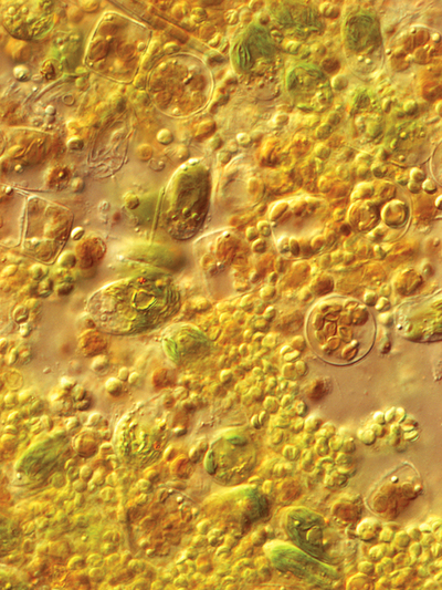 Phyto-Feast marine microalgae under microscope