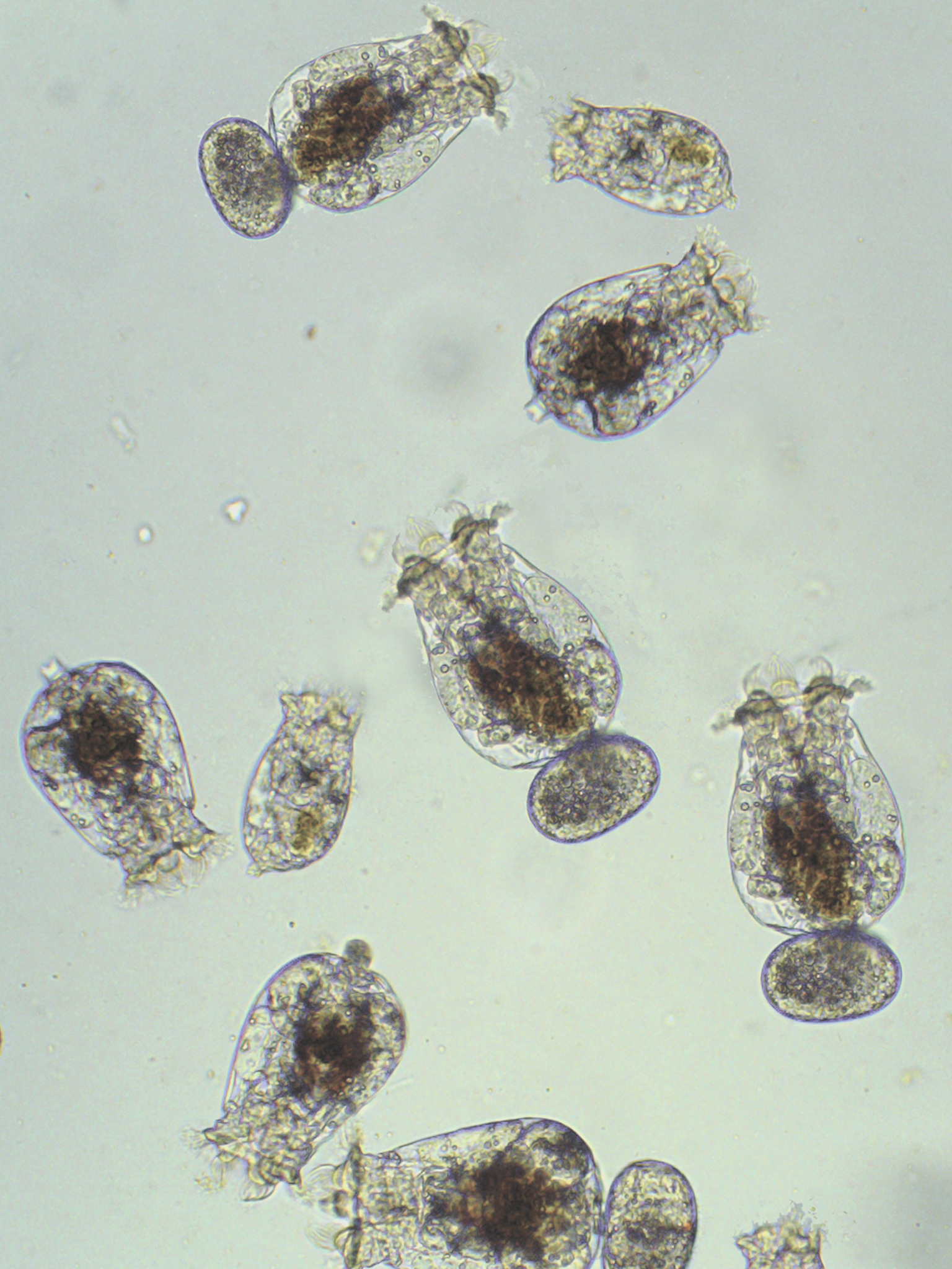 Roti-Feast rotifers under microscope